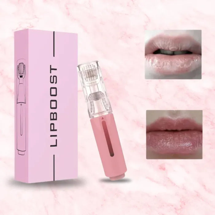 Voraal| lip filler kit hyaluronzuur als geschenk