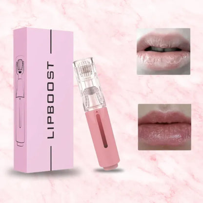 Voraal| lip filler kit hyaluronzuur als geschenk